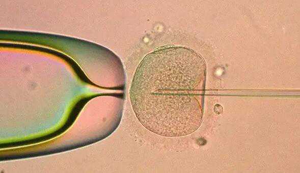 厦门借卵代孕产子价格_第三代试管婴儿PGT筛查有哪些优点和缺点？