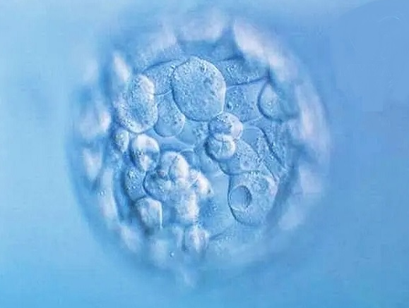 厦门代孕机构供卵-西囡医院供卵等多久